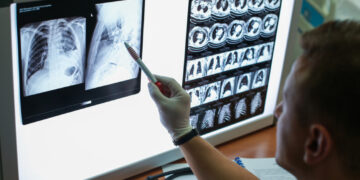 Tumore al polmone,un secondo parere medico da ‘I 100 Medici eccellenti d’Italia’