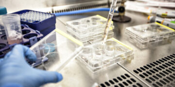 Attivato il protocollo per un sospetto caso di Ebola in Trentino