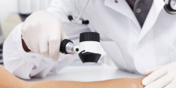Successo del farmaco antimelanoma, Moderna strappa a Wall Street