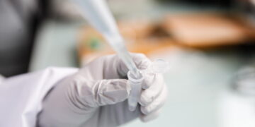 Tumore del polmone, con nuova molecola sopravvivenza a 8 anni del 79%
